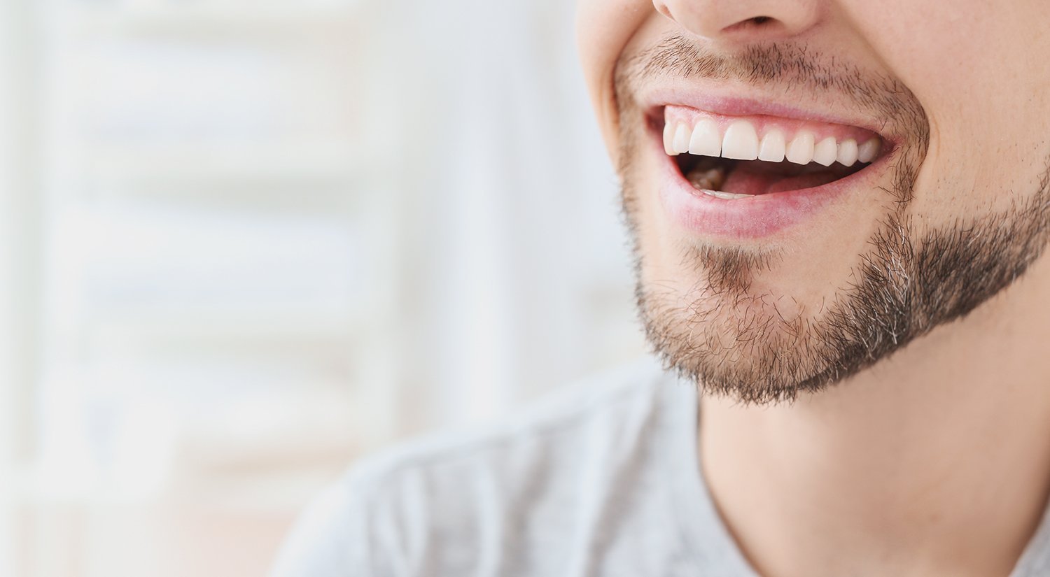 Why Your Teeth Whitening Kit Didn’t Work - ToothStars